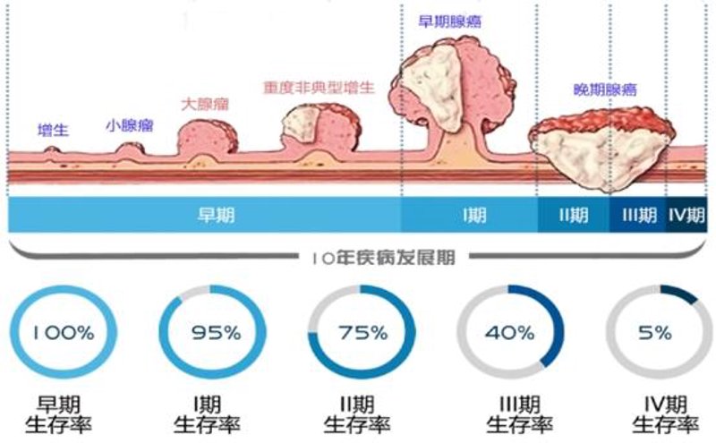 肿瘤早筛：守护健康的隐形盾牌